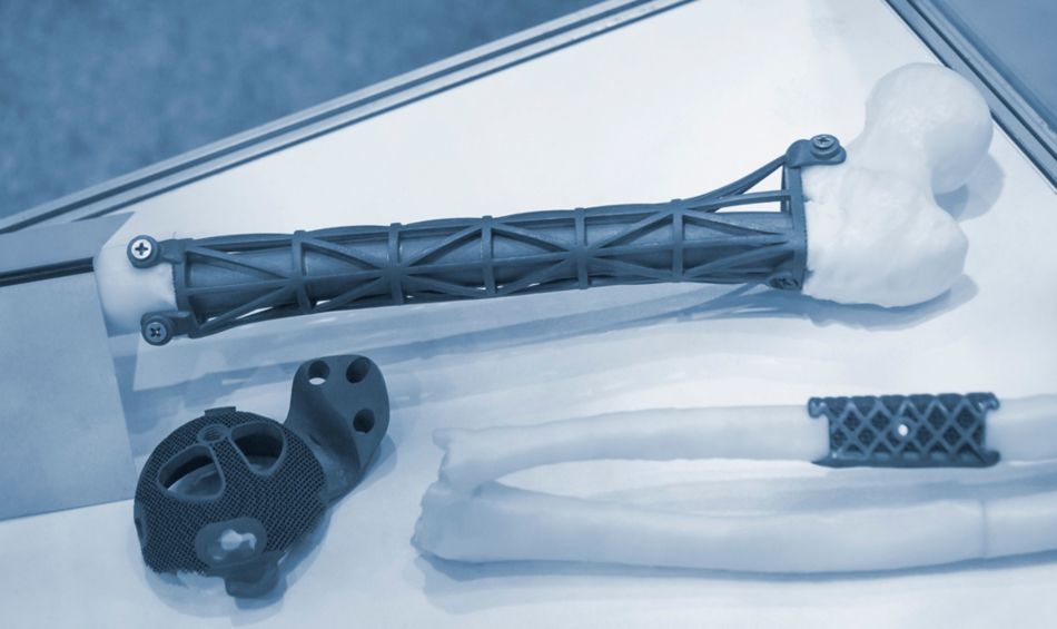Implants and prostheses printed on 3D printer from biocompatible titanium powder.